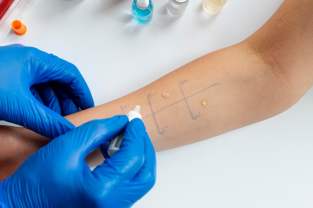 Surgical Treatments